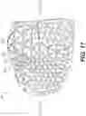 Fig. 15 - Method of customizing a sole structure of an article of footwear