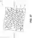 Fig. 25 - Method of customizing a sole structure of an article of footwear