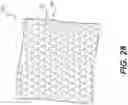 Fig. 26 - Method of customizing a sole structure of an article of footwear