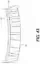 Fig. 41 - Method of customizing a sole structure of an article of footwear