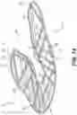 Fig. 11 - Three-dimensional printing of a traced element
