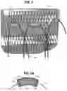 Fig. 04 - Knitted component having a knitted anchor portion