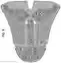 Fig. 09 - Knitted component having a knitted anchor portion