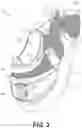 Fig. 04 - Footwear having motorized adjustment system and elastic upper