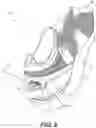 Fig. 09 - Footwear having motorized adjustment system and elastic upper