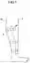 Fig. 02 - Toggle lever closure