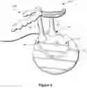 Fig. 05 - Methods of making personalized toothbrush devices