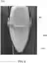 Fig. 07 - Inverted bottle hanging apparatus