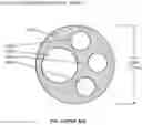 Fig. 03 - System and apparatus comprising a multi-sensor catheter for right heart and pulmonary artery catheterization