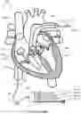Fig. 04 - System and apparatus comprising a multi-sensor catheter for right heart and pulmonary artery catheterization
