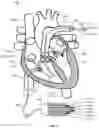 Fig. 09 - System and apparatus comprising a multi-sensor catheter for right heart and pulmonary artery catheterization