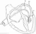 Fig. 01 - Methods and systems for statistically analyzing electrograms for local abnormal ventricular activities and mapping the same