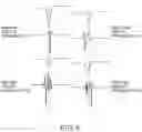Fig. 09 - Methods and systems for statistically analyzing electrograms for local abnormal ventricular activities and mapping the same