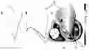 Fig. 01 - Heart condition determination method and system