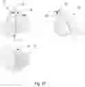 Fig. 10 - Heart condition determination method and system