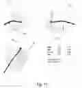 Fig. 11 - Heart condition determination method and system