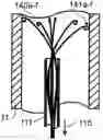 Fig. 01 - CONTROLLED SYMPATHECTOMY AND MICRO-ABLATION SYSTEMS AND METHODS