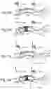Fig. 05 - CONTROLLED SYMPATHECTOMY AND MICRO-ABLATION SYSTEMS AND METHODS