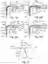 Fig. 07 - CONTROLLED SYMPATHECTOMY AND MICRO-ABLATION SYSTEMS AND METHODS