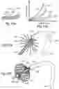 Fig. 11 - CONTROLLED SYMPATHECTOMY AND MICRO-ABLATION SYSTEMS AND METHODS