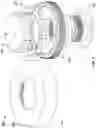 Fig. 03 - Systems and methods for surgical guide for real-time MRI surgery
