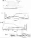 Fig. 06 - SELECTION, SEGMENTATION AND ANALYSIS OF EXHALED BREATH FOR AIRWAY DISORDERS ASSESSMENT