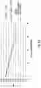 Fig. 03 - Optical glucometer