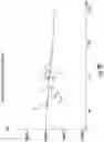 Fig. 29 - Optical glucometer