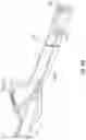 Fig. 29 - ARTERIAL SYRINGE ASSEMBLY