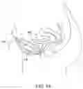 Fig. 07 - Apparatus, systems and methods for sensing bladder fullness