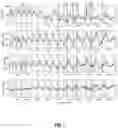 Fig. 09 - METHOD AND SYSTEM FOR CARDIOVASCULAR RISK ASSESSMENT USING PROGRAMMED ACTIVITY OF DAILY LIVING