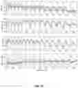Fig. 12 - METHOD AND SYSTEM FOR CARDIOVASCULAR RISK ASSESSMENT USING PROGRAMMED ACTIVITY OF DAILY LIVING