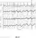 Fig. 16 - METHOD AND SYSTEM FOR CARDIOVASCULAR RISK ASSESSMENT USING PROGRAMMED ACTIVITY OF DAILY LIVING