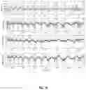 Fig. 17 - METHOD AND SYSTEM FOR CARDIOVASCULAR RISK ASSESSMENT USING PROGRAMMED ACTIVITY OF DAILY LIVING