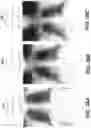 Fig. 33 - Mobile radiography calibration for tomosynthesis using epipolar data consistency
