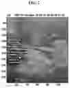 Fig. 03 - Non-invasive method for pressure measurement