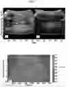 Fig. 06 - Non-invasive method for pressure measurement