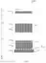 Fig. 05 - Modular piezoelectric sensor array with co-integrated electronics and beamforming channels