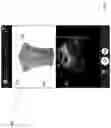 Fig. 05 - METHODS AND APPARATUSES FOR DETERMINING AND DISPLAYING LOCATIONS ON IMAGES OF BODY PORTIONS BASED ON ULTRASOUND DATA