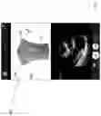 Fig. 08 - METHODS AND APPARATUSES FOR DETERMINING AND DISPLAYING LOCATIONS ON IMAGES OF BODY PORTIONS BASED ON ULTRASOUND DATA