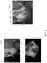 Fig. 04 - Method and system for visualizing overlapping images