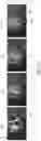 Fig. 09 - Method and system for visualizing overlapping images