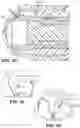 Fig. 05 - Punch biopsy device