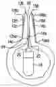 Fig. 01 - Devices and methods for reducing a dimension of openings in tissue