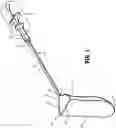 Fig. 02 - Specimen retrieval device