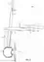 Fig. 10 - Surgical access system and related methods