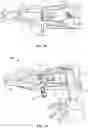 Fig. 11 - Surgical access system and related methods