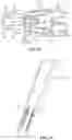 Fig. 13 - Surgical access system and related methods