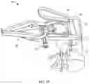Fig. 15 - Surgical access system and related methods