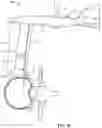 Fig. 18 - Surgical access system and related methods